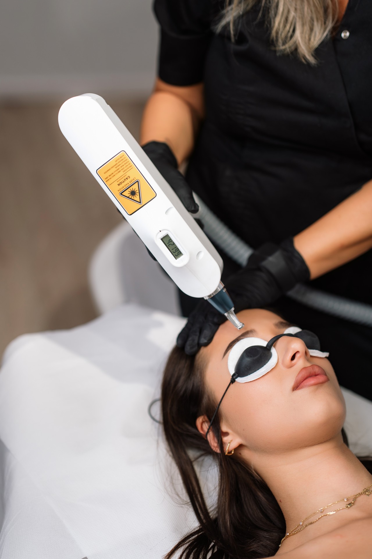 Indepartare tatuaj cosmetic cu laser image